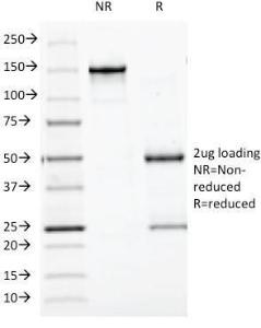 SDS-PAGE analysis of Anti-BCL10 Antibody [BL10/411] under non-reduced and reduced conditions; showing intact IgG and intact heavy and light chains, respectively SDS-PAGE analysis confirms the integrity and purity of the antibody