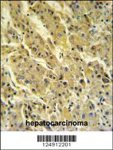 Anti-PSG7 Rabbit Polyclonal Antibody