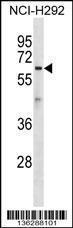 Anti-ATL1 Rabbit Polyclonal Antibody (Biotin)