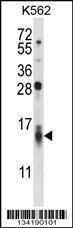 Anti-CCL15 Rabbit Polyclonal Antibody (FITC (Fluorescein Isothiocyanate))