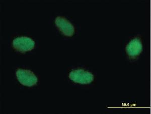 Anti-ELAC2 Mouse Monoclonal Antibody [clone: 1A2]