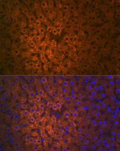 Anti-FMO3 antibody