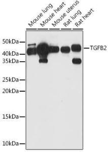 Western blot analysis of extracts of various cell lines, using Anti-TGF beta 2 Antibody (A11669) at 1:1,000 dilution