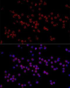 Anti-HADHA Rabbit Polyclonal Antibody