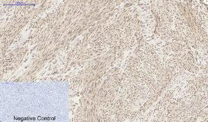 Immunohistochemical analysis of paraffin-embedded human uterus tissue using Anti-MyD88 Antibody at 1:200 (4°C overnight). Negative control was secondary antibody only.