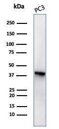 Anti-Maspin Mouse Monoclonal Antibody [clone: SERPINB5/4977]