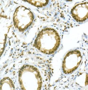 Immunohistochemistry analysis of paraffin-embedded human colon tissue using Anti-PGC1 alpha Antibody (A305531) at a dilution of 1:20 (40X lens). Perform high pressure antigen retrieval with 10 mM citrate buffer pH 6.0 before commencing with IHC staining protocol