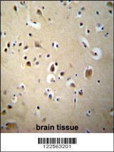 Anti-SIAH2 Rabbit Polyclonal Antibody (FITC (Fluorescein Isothiocyanate))