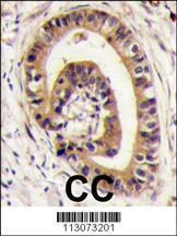 Anti-GOPC Rabbit Polyclonal Antibody (AP (Alkaline Phosphatase))