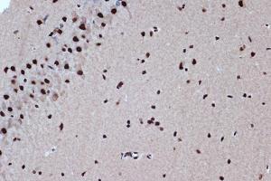 Immunohistochemistry analysis of paraffin-embedded rat brain using Anti-Bub3 Antibody [ARC1318] (A307916) at a dilution of 1:100 (40x lens). Perform microwave antigen retrieval with 10 mM Tris/EDTA buffer pH 9.0 before commencing with IHC staining protocol.