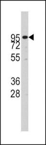 Anti-ADAM17 Rabbit Polyclonal Antibody (APC (Allophycocyanin))