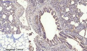 Immunohistochemical analysis of paraffin-embedded rat lung tissue using Anti-MyD88 Antibody at 1:200 (4°C overnight). Negative control was secondary antibody only.