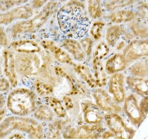 Immunohistochemistry analysis of paraffin-embedded mouse kidney using Anti-PGC1 alpha Antibody (A305531) at a dilution of 1:20 (40X lens). Perform high pressure antigen retrieval with 10 mM citrate buffer pH 6.0 before commencing with IHC staining protocol