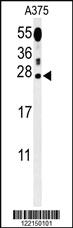 Anti-ITPA Rabbit Polyclonal Antibody