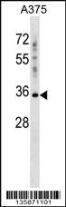 Anti-PSG2 Rabbit Polyclonal Antibody