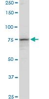 Anti-PCCA Mouse Polyclonal Antibody