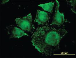 Anti-SGK2 Mouse Monoclonal Antibody [clone: 7C7]