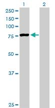 Anti-PCCA Mouse Polyclonal Antibody