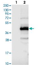 Anti-C11ORF49 Rabbit Polyclonal Antibody