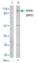 Anti-NFKB1 Rabbit Polyclonal Antibody