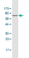 Anti-HAVCR1 Mouse Monoclonal Antibody [clone: 2G11]