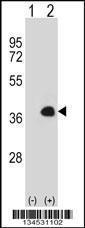 Anti-MEOX1 Rabbit Polyclonal Antibody