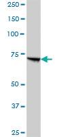 Anti-PCCA Mouse Polyclonal Antibody