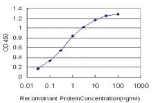 Anti-SGK2 Mouse Monoclonal Antibody [clone: 7C7]