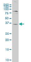 Anti-GPR62 Mouse Polyclonal Antibody