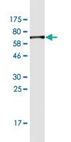 Anti-HAVCR1 Mouse Monoclonal Antibody [clone: 1G1]