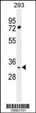 Anti-FRG2B Rabbit Polyclonal Antibody (APC (Allophycocyanin))