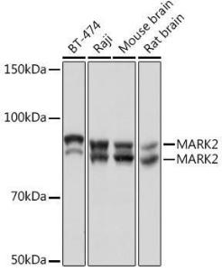 Anti-MARK2 Rabbit Monoclonal Antibody [clone: ARC1862]