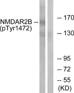 Western blot analysis of lysates from Jurkat cells treated with UV 15' using Anti-NMDAR2B (phospho Tyr1474) Antibody. The right hand lane represents a negative control, where the antibody is blocked by the immunising peptide