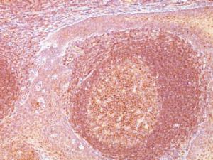 Immunohistochemical analysis of formalin-fixed, paraffin-embedded human tonsil using Anti-BCL10 Antibody [SPM520]