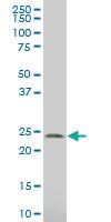 Anti-SPCS3 Mouse Polyclonal Antibody