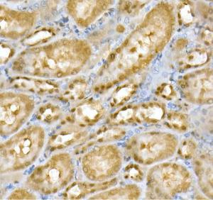 Immunohistochemistry analysis of paraffin-embedded rat kidney using Anti-PGC1 alpha Antibody (A305531) at a dilution of 1:20 (40X lens). Perform high pressure antigen retrieval with 10 mM citrate buffer pH 6.0 before commencing with IHC staining protocol