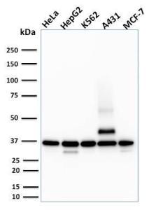 Western blot analysis of HeLa, HepG2, K562, A431, and MCF-7 cell lysates using Anti-RAD51 Antibody [RAD51/2701]