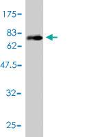 Anti-PLTP Mouse Monoclonal Antibody [clone: 2F3-G4]