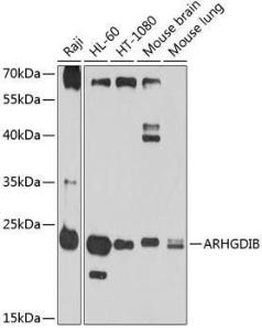 Western blot analysis of extracts of various cell lines, using Anti-D4 GDI Antibody (A11678) at 1:1000 dilution. The secondary Antibody was Goat Anti-Rabbit IgG H&L Antibody (HRP) at 1:10000 dilution. Lysates/proteins were present at 25 µg per lane