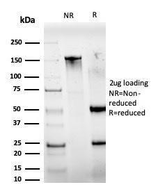 SDS-PAGE analysis of Anti-IRF3 Antibody [PCRP-IRF3-6C8] under non-reduced and reduced conditions; showing intact IgG and intact heavy and light chains, respectively. SDS-PAGE analysis confirms the integrity and purity of the antibody