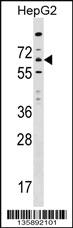 Anti-ITPRIPL1 Rabbit Polyclonal Antibody