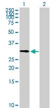 Anti-ZNF511 Mouse Polyclonal Antibody