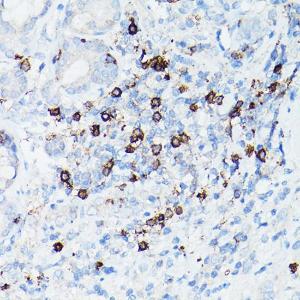 Immunohistochemistry analysis of paraffin-embedded human T-cell malignant lymphoma using Anti-CD8 alpha Antibody [ARC0329] (A306457) at a dilution of 1:100 (40X lens). Perform high pressure antigen retrieval with 10 mM citrate buffer pH 6.0 before commencing with IHC staining protocol