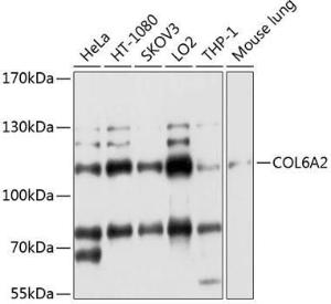 Anti-Collagen VI antibody