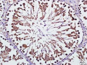 Formalin-fixed and paraffin embedded Rat Testis tissue labeled with RNF138 Polyclonal Antibody (bs-9254R) at 1:200, followed by conjugation to the seconary antibody and DAB staining