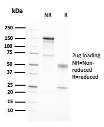 SDS-PAGE analysis of Anti-RAD51 Antibody [RAD51/2701] under non-reduced and reduced conditions; showing intact IgG and intact heavy and light chains, respectively. SDS-PAGE analysis confirms the integrity and purity of the antibody.