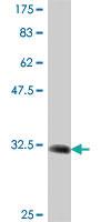 Anti-OPRK1 Mouse Polyclonal Antibody