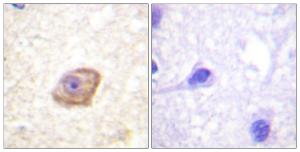 Immunohistochemical analysis of paraffin-embedded human brain using Anti-NMDAR2B (phospho Tyr1474) Antibody. The right hand panel represents a negative control, where the antibody was pre-incubated with the immunising peptide