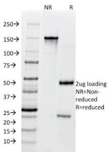 SDS-PAGE analysis of Anti-BCL10 Antibody [SPM520] under non-reduced and reduced conditions; showing intact IgG and intact heavy and light chains, respectively. SDS-PAGE analysis confirms the integrity and purity of the antibody