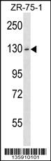 Anti-HKDC1 Rabbit Polyclonal Antibody